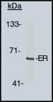Western blot analysis using estrogen receptor antibody on human cells at 1-2 µg/ml.